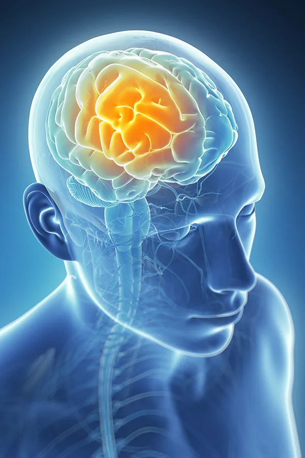 Migraine-Treatment 3D illustration of the brain with glowing pain center. Tanya Zboril, NP of TBT Medical treats migraines using functional medicine in Regina.