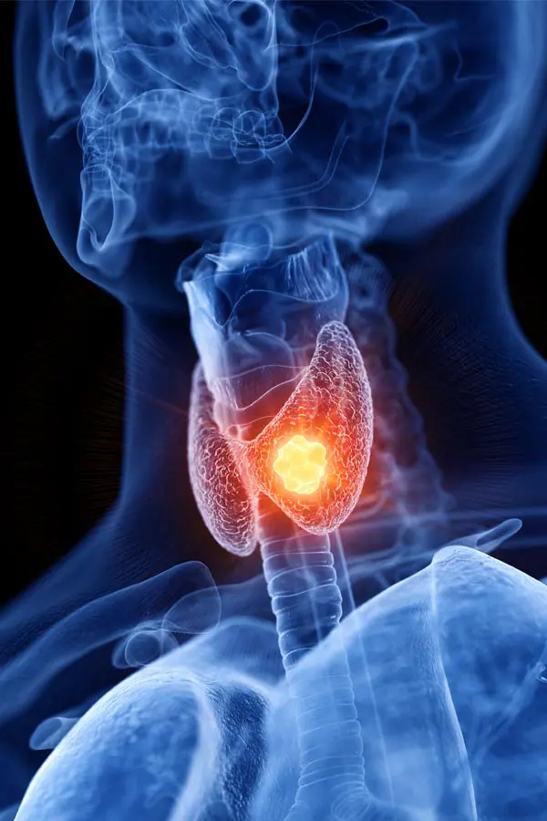 A 3D illustration of an x-ray of a human neck, highlighting the thyroid. Get help with thyroid imbalance from Tanya Zboril, NP of TBT Medical in Regina.
